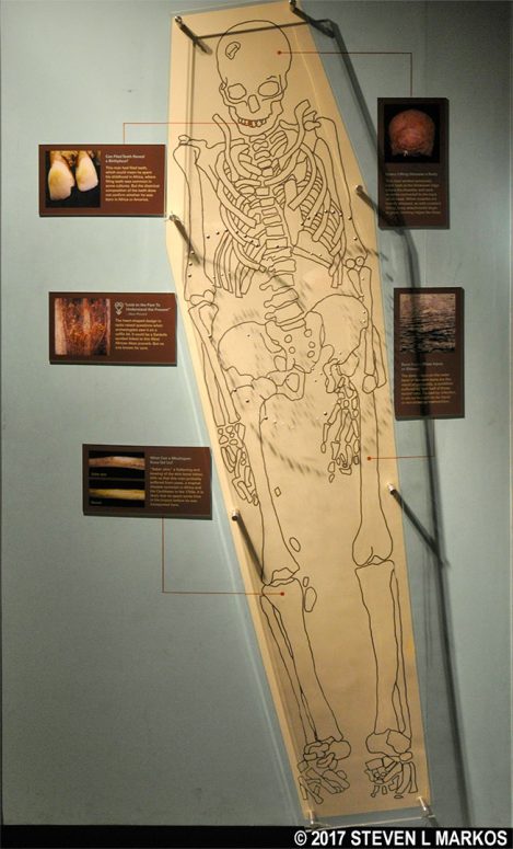 Forensic information on one of the skeletons exhumed at the African Burial Ground in New York City